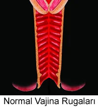 Normal vajina